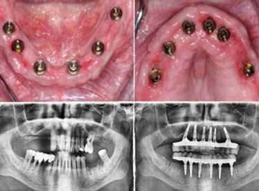 What's Included at Stunning Dentistry