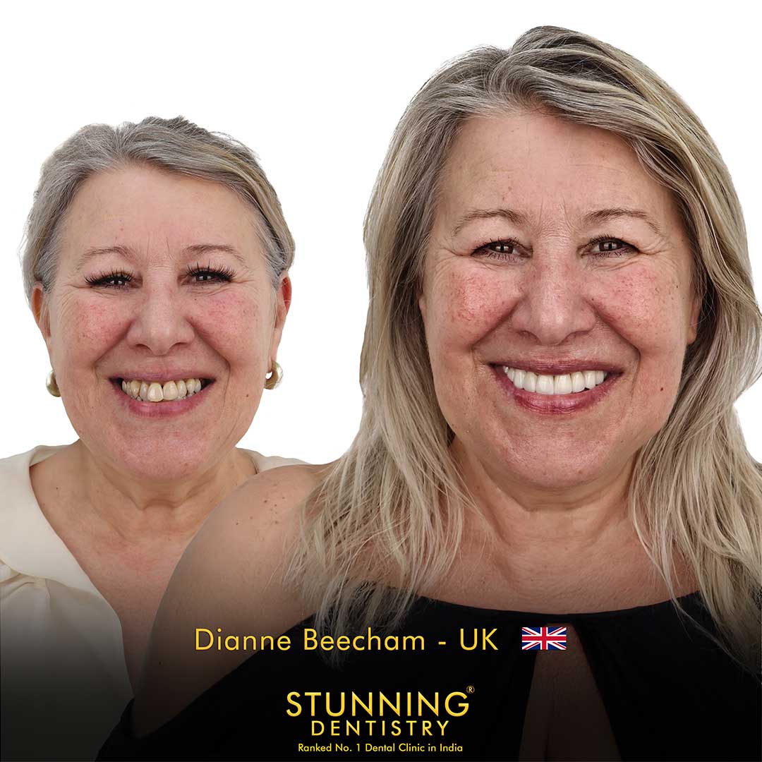 Full Smile Transformation - photo 1