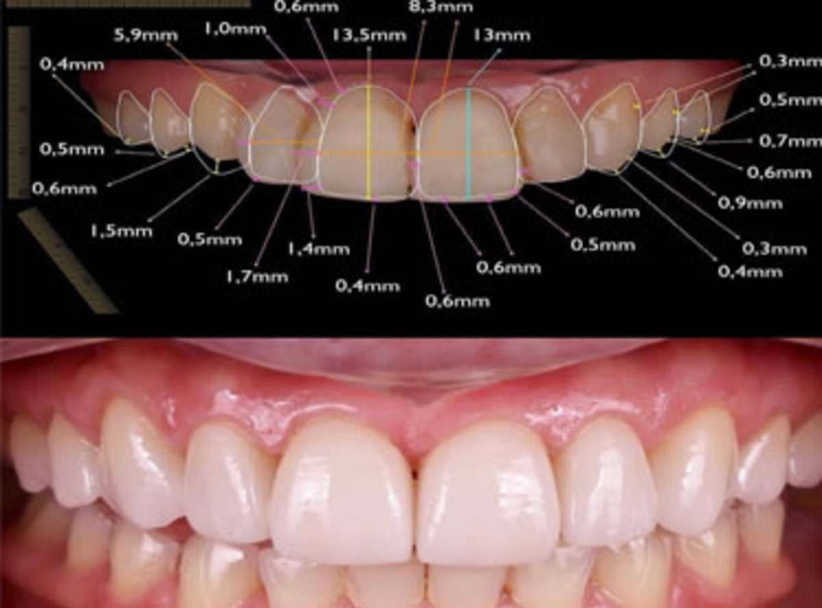 Smile Design vs Single-Issue Cosmetic Dentistry