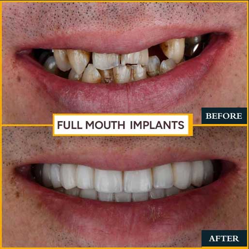 Smile Makeover - photo 2