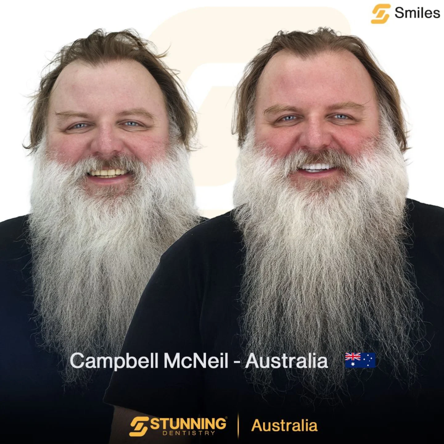 Campbell – photo 4